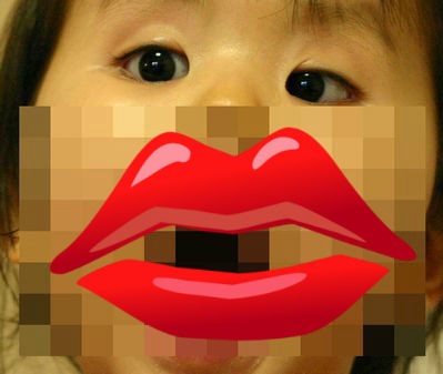 最初に内斜視に気づいた時 弱視による斜視治療の記録