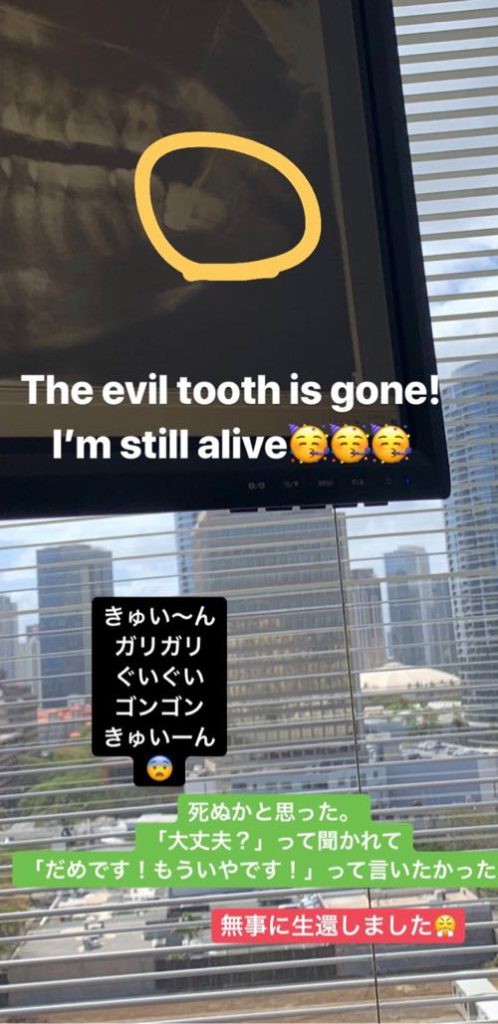 ハワイで２回目の親知らず抜歯 値段や時間 流れ 抜歯後経過など アメリカ暮らし ハワイネコ ブログ