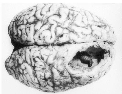 朗報 キムチに育毛効果 世界キムチ研究所が確認 商品化を推進 天音リスの住処