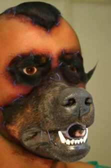 閲覧注意 整形で犬のような顔になってしまった男 アモドリス