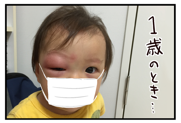 蚊に刺されたことを伝える言い方がかわいい いっちょまえ姉妹を育てています Powered By ライブドアブログ