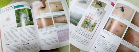 Dr.夏秋の臨床図鑑 虫と皮膚炎-connectedremag.com