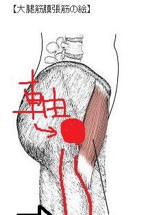 膝関節伸展制限に対する理学療法 大腿筋膜張筋を緩めよう 理学療法士 ｐｔ だって 人間だもん