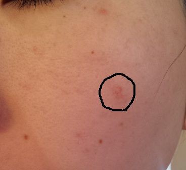 メコゾーム ブライトニングフォーミュラ Areki S Blog