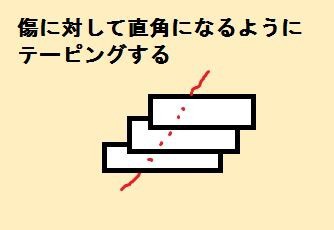 東京 ホクロ除去で保険適用できるのは池袋サンシャイン美容外科 大きなホクロは保険適用でお安く取る 浦和裏日記 さいたま市の地域ブログ