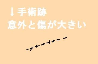 東京 ホクロ除去で保険適用できるのは池袋サンシャイン美容外科 大きなホクロは保険適用でお安く取る 浦和裏日記 さいたま市の地域ブログ 東京 ホクロ除去で保険適用できるのは池袋サンシャイン美容外科 大きなホクロは保険適用でお安く取る 浦和裏日記 さいたま市の地域ブログ