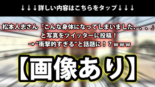 画像あり とあるオシャレな ニットコルセット が完全に 天才バカボンの腹巻 に見えるとtwitterで話題に ｗｗｗ ネクスト速報