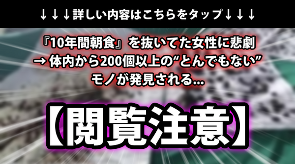 閲覧注意 10年間朝食 を抜いてた女性に悲劇 体内から200個以上の とんでもないモノ が発見される ネクスト速報