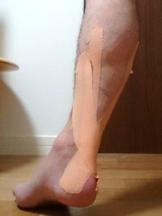 アキレス腱の治療には接骨院が最適か 18週末 アキレス腱断裂の治療とリハビリ闘病記