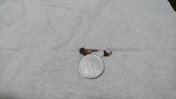 画像 マジでやばいへそのゴマ取れた まとめたニュース