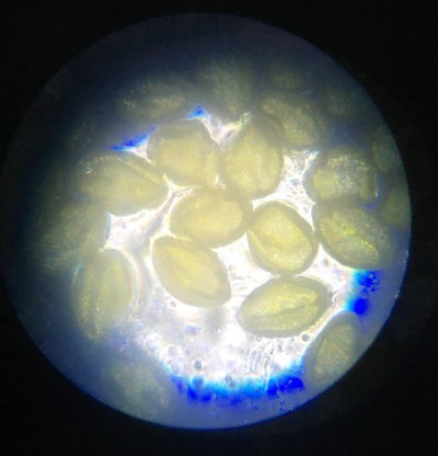 ヘチマの花粉を顕微鏡で見る Ipadとiphoneで教師の仕事をつくる