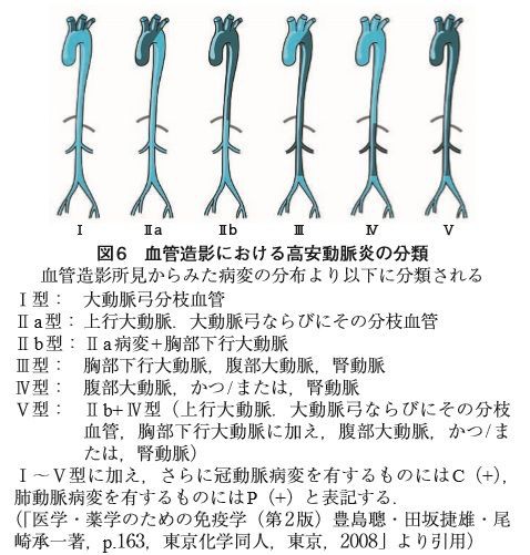 選択問題９ 大血管 末梢血管疾患 血管内治療を除く 2 大動脈瘤など大動脈疾患 心臓血管外科専門医認定試験対策