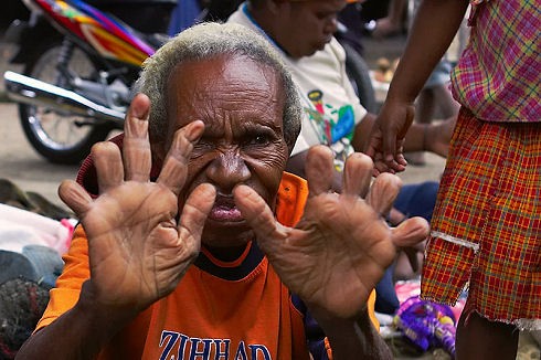 話題 指を切断される葬送の儀式 ダニ族の女性に施される過酷な風習 ニューギニア 付録部 Blog Bu