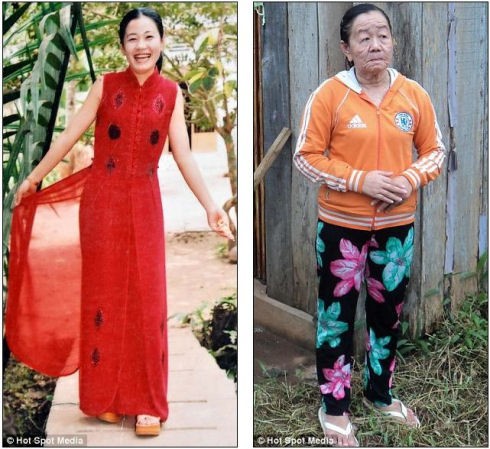 話題 たった数日で老女と化したベトナム人女性 付録部 Blog Bu