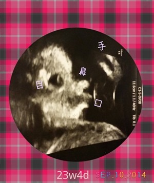 23w4dの健診 今の気持ち 横顔エコー 旧 おいしい毎日しあわせごはん