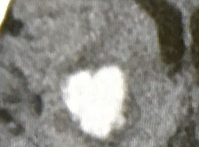 CA7B3970-A17A-46A6-B85B-74452020D5A9