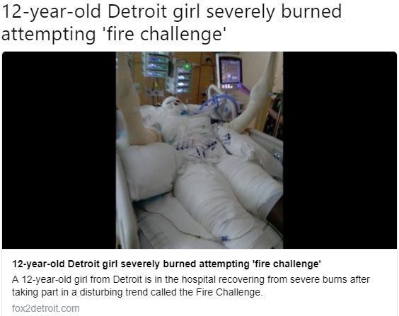 Youtubeで大流行している ファイアーチャレンジ を真似した12歳女児が全身大火傷 アダルトなblog