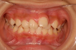 石巻 市 審美 歯科