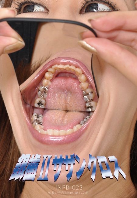 銀歯 サザンクロス 新 デブ狂四郎のblog