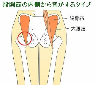 バレリーナに多い股関節の痛み コウシンドウのblog