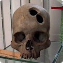 トレパネーション モノ太郎の雑学コラム