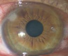 アイボンなどのカップ型の目に当てる洗眼は目に良い 目に悪い 頻繁にしているとドライアイがひどくなったり 角膜に傷を作ることも ある奈良県の眼科医が目について書いたブログ