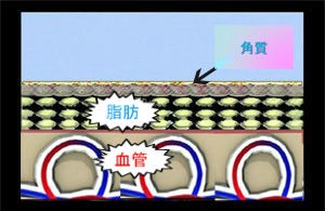 アイプチの危険性とトラブル もしも使ったアイプチが合わないとこんなひどいかぶれをおこすことも ある奈良県の眼科医が目について書いたブログ