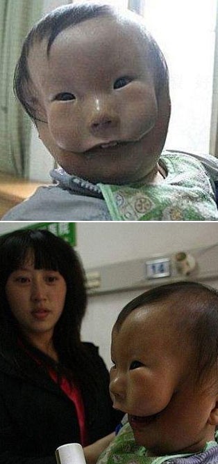 放射能の影響か 中国で仮面をかぶったような顔の子どもが生まれる テストサイト