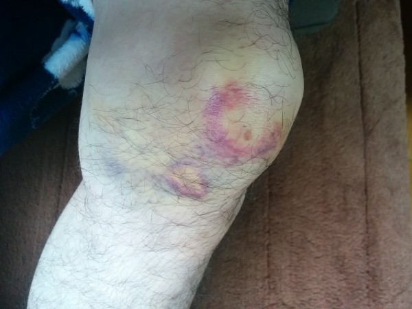 コミネ オールシーズンプロテクションジャケット購入 元バイクレーサーの街乗りな日々