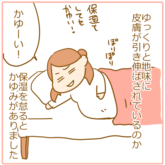 双子妊娠レポ9 双子の妊娠線って予防できるの ふたごむすめっこ すえむすめっこ Powered By ライブドアブログ