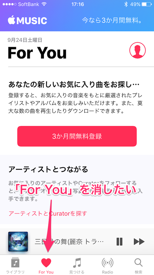 Ios10にするとしれっと復活するappleミュージック For You を消す設定方法 特報ガジェq