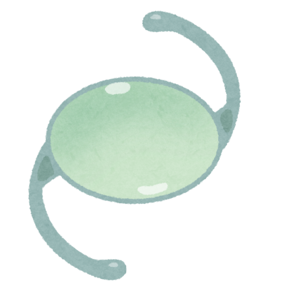 怖い Icl手術 眼内コンタクト挿入手術 やろうとおもうんだが やったことあるやつ ガールズvipまとめ