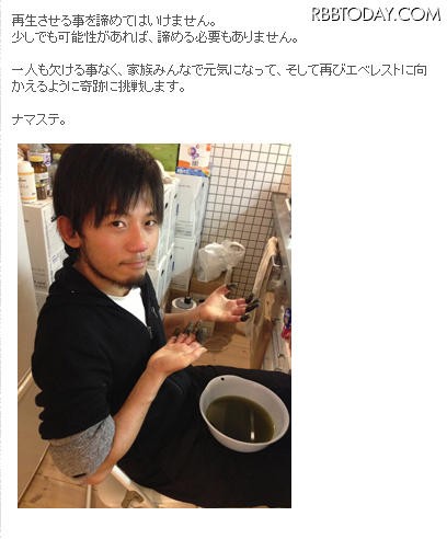 画像あり】登山家・栗城史多さん、凍傷で切断危機の両手指の再生へ向けて挑戦 : 芸スポまとめ速報