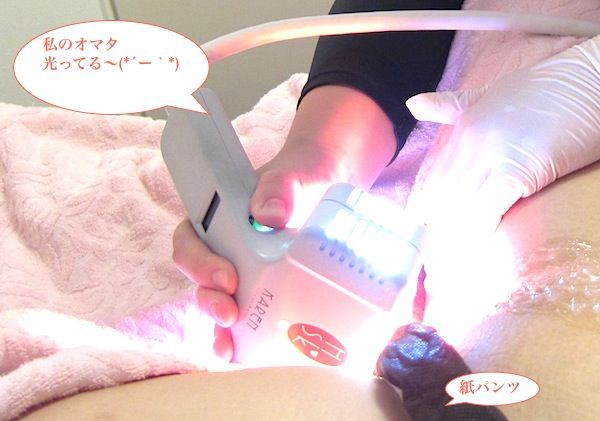 痛くないdioneの全身脱毛をレポート体験ヽ ﾉ閲覧注意 アソコもろ出しです Vio脱毛写真で説明 閲覧注意 銀座カラーでiライン をハイジニーナ脱毛した私の脱毛エステ体験談