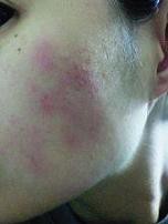 なんなの Keyhole