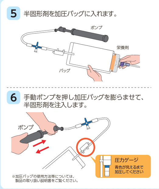 Nf 配合 ラコール半固形 加圧バッグ 電動 PG加圧Qシリーズセット PG
