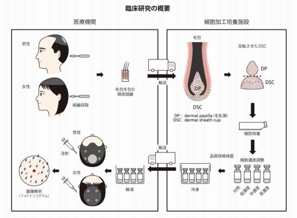 朗報 年とともにハゲる 壮年性脱毛症 の新たな治療法が開発される ハゲルヤ ハゲと向き合うウェブマガジン