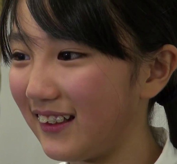 印刷可能 歯科矯正 2ch 1085 歯科矯正 2ch