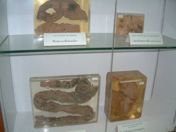 死体博物館 写真を見たい人用 Hammock Life ハンモックライフ 死体博物館 写真を見たい人用 Hammock Life ハンモックライフ