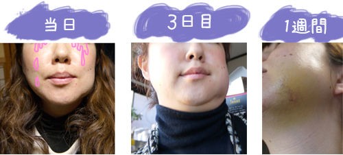 味覚障害 口の中がしょっぱい いろんな病院へ 治療方法 Good Life