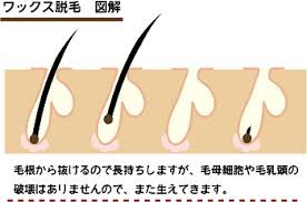 Avanti Beauty Spa Thonglo アヴァンティ ビューティー スパ トンロー店 男性ビキニラインｏｋ 7oct13 バンコク Spa スパ と裏道