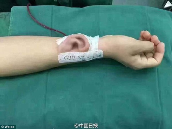 引用画像