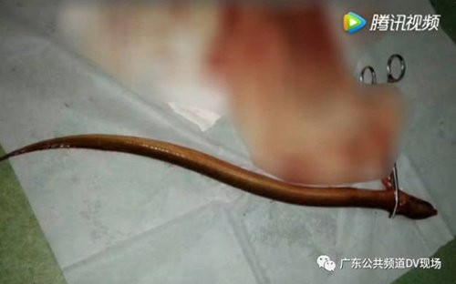 引用画像