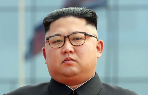 北朝鮮 金正恩氏 心臓を悪くして緊急入院 手術を行うもあまりにデブすぎて8倍の時間がかかる 植物人間になったとの報道 はちま起稿