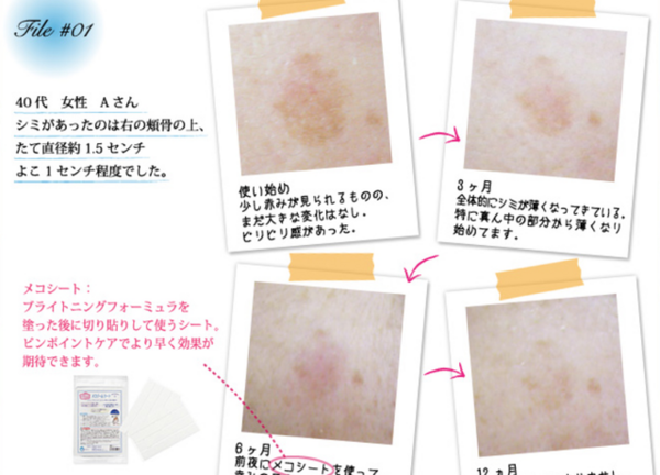 先着500名の特別価格 できちゃったシミに効果絶大 美容ドクターと共同開発の酵素コスメ メコゾーム ブライトニングフォーミュラ 恵比寿 銀座大好き 新米フードアナリスト ハツのブログ