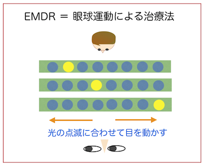 トラウマ治療 Emdr Nhkクロ ズアップ現代より 意外と知らない 目の話