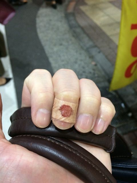 ささくれを引っ張る 廣木涼のオフィシャルブログ