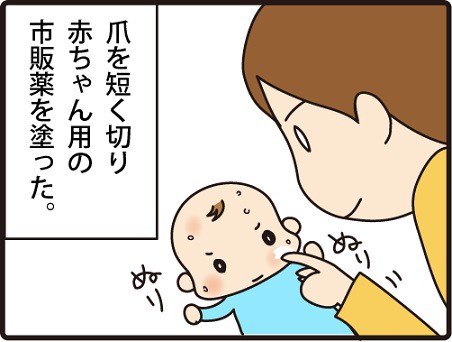 最初に 辛な 冷える ポリベビー 顔 4invisalign Com 最初に 辛な 冷える ポリベビー 顔 4invisalign Com