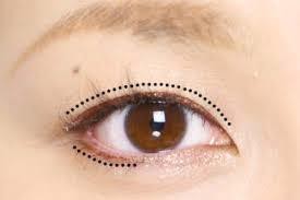 完全一重のブサメンが片目を無理やり二重にしようとして半年経った結果 私的なニュース速報