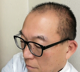 スキンヘッドを1カ月伸ばしてみたら 英語教室 以学館 教室便り